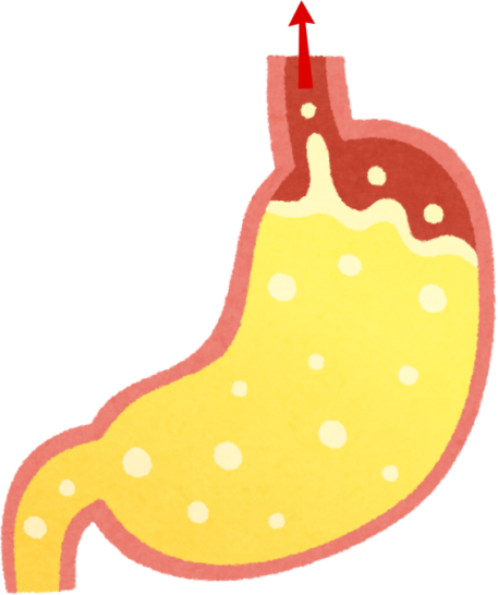 Gastro-Esophageal Reflux / Increased Vomiting