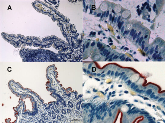 PCH2cure Arbeitspaket Magen-Darm-Symptome bei PCH2A