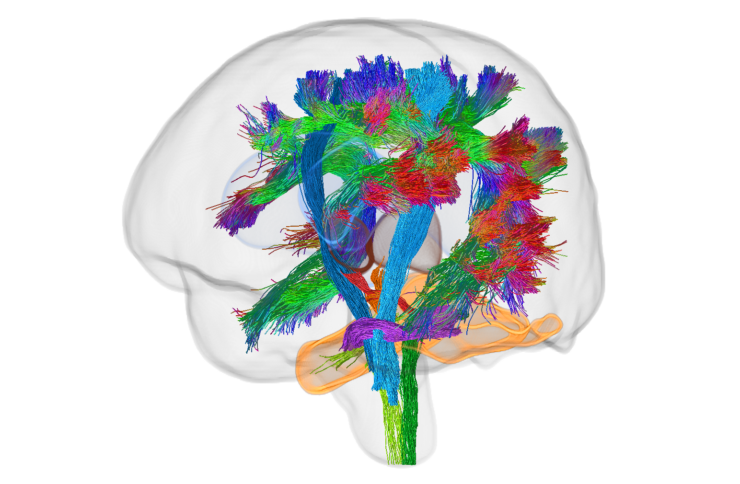 PCH2cure Work Packages: Imaging of the Brain