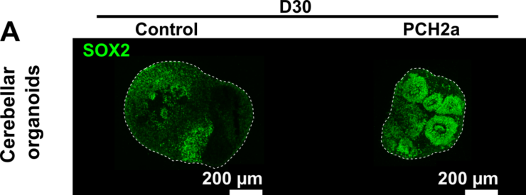 Brain Models Help in Researching PCH2