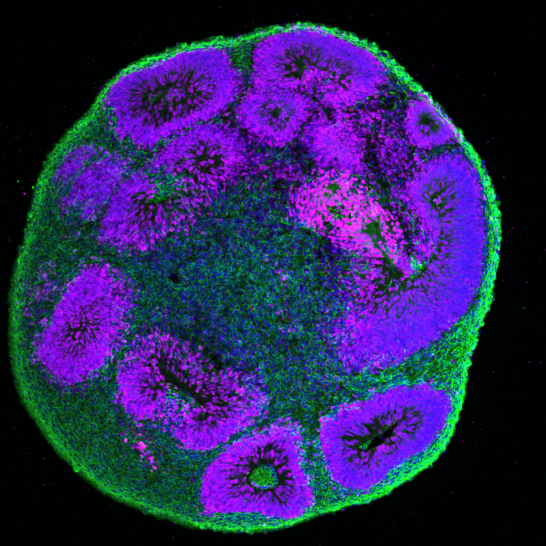 PCH2cure Arbeitspaket Gehirnorganoide als Modell für PCH2