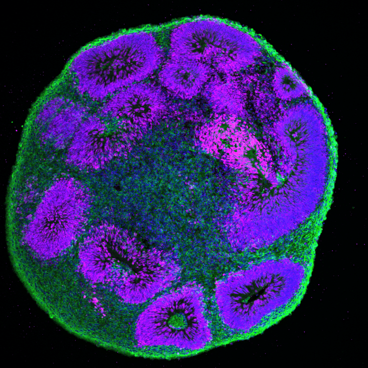 PCH2cure Arbeitspaket Gehirnorganoide als Modell für PCH2